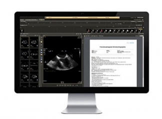 Philips IntelliSpace Cardiovascular Extension
